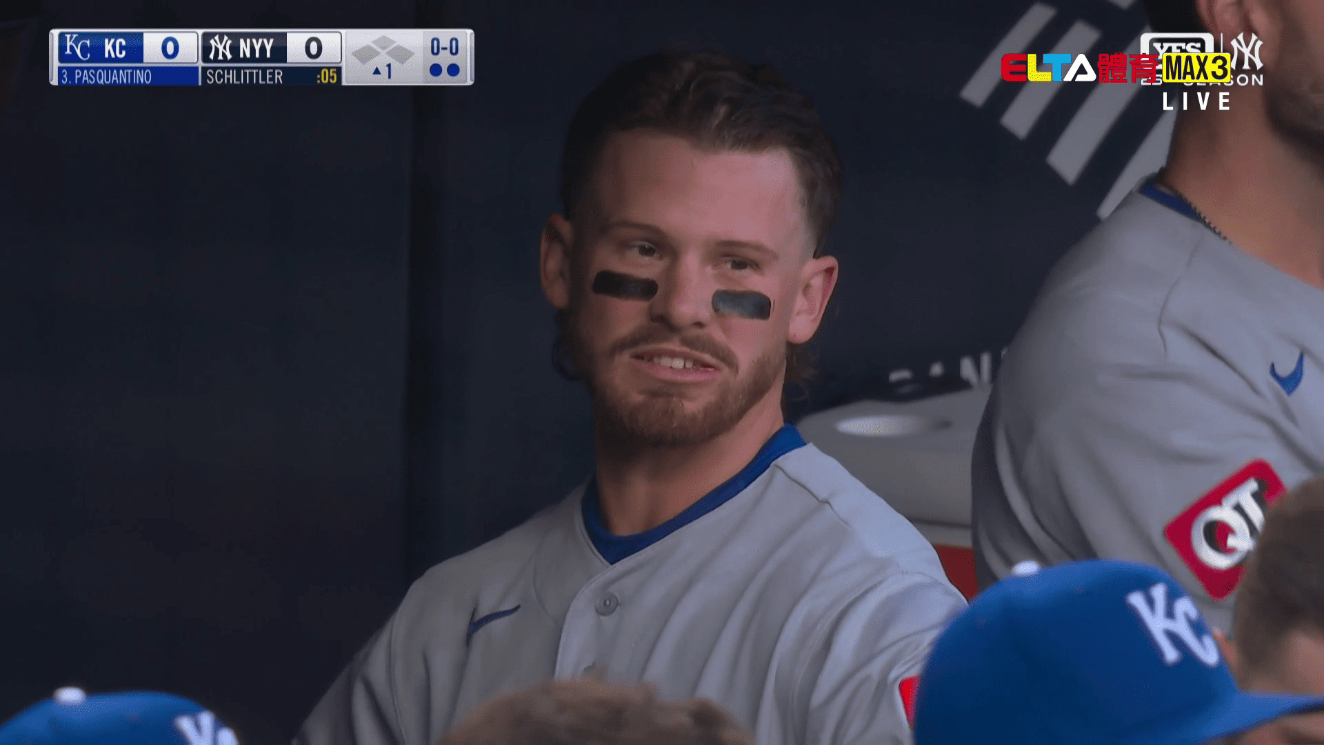 4/18 MLB 皇家 VS 洋基(原音) 