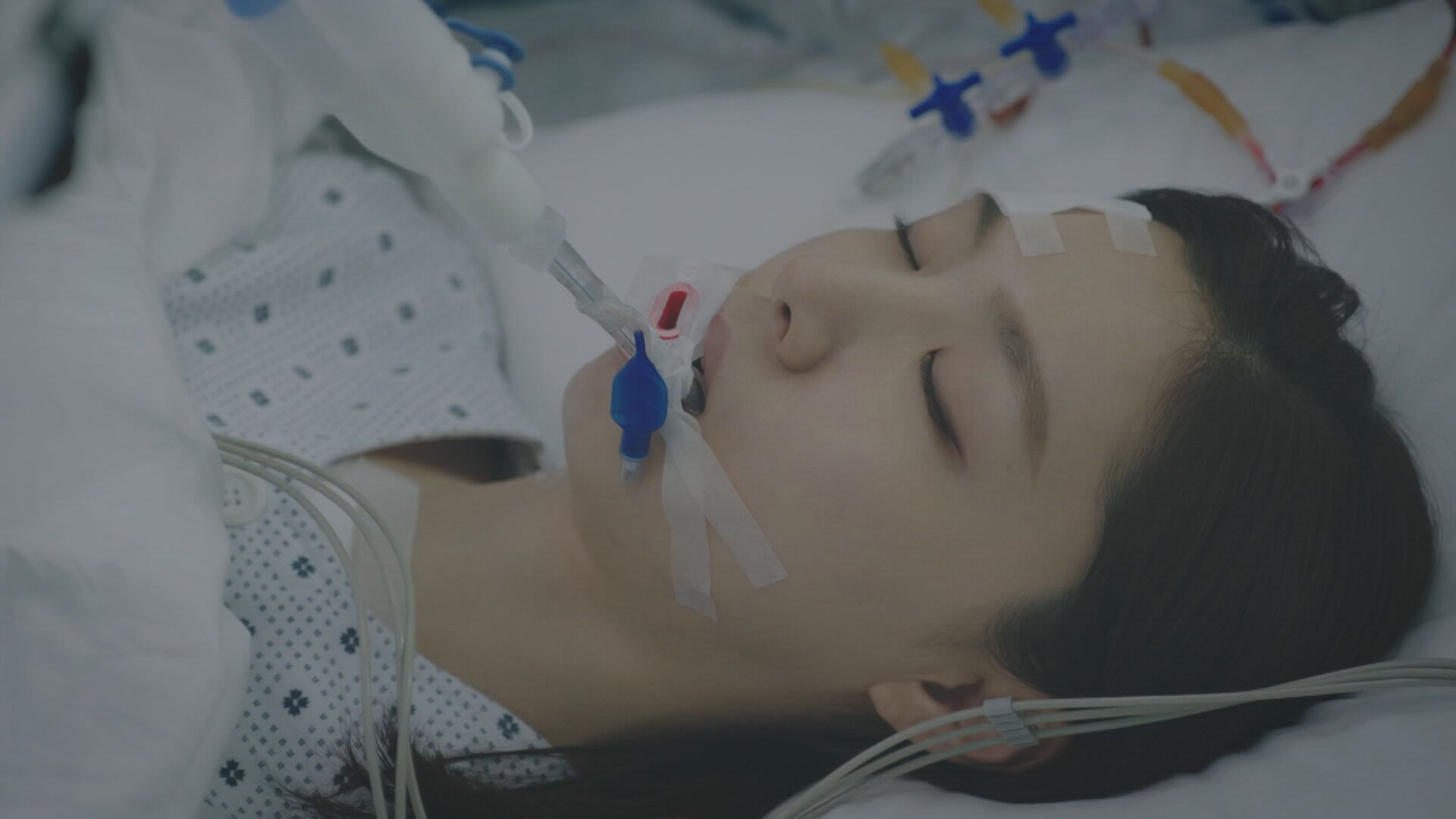 胸腔外科－盜心師